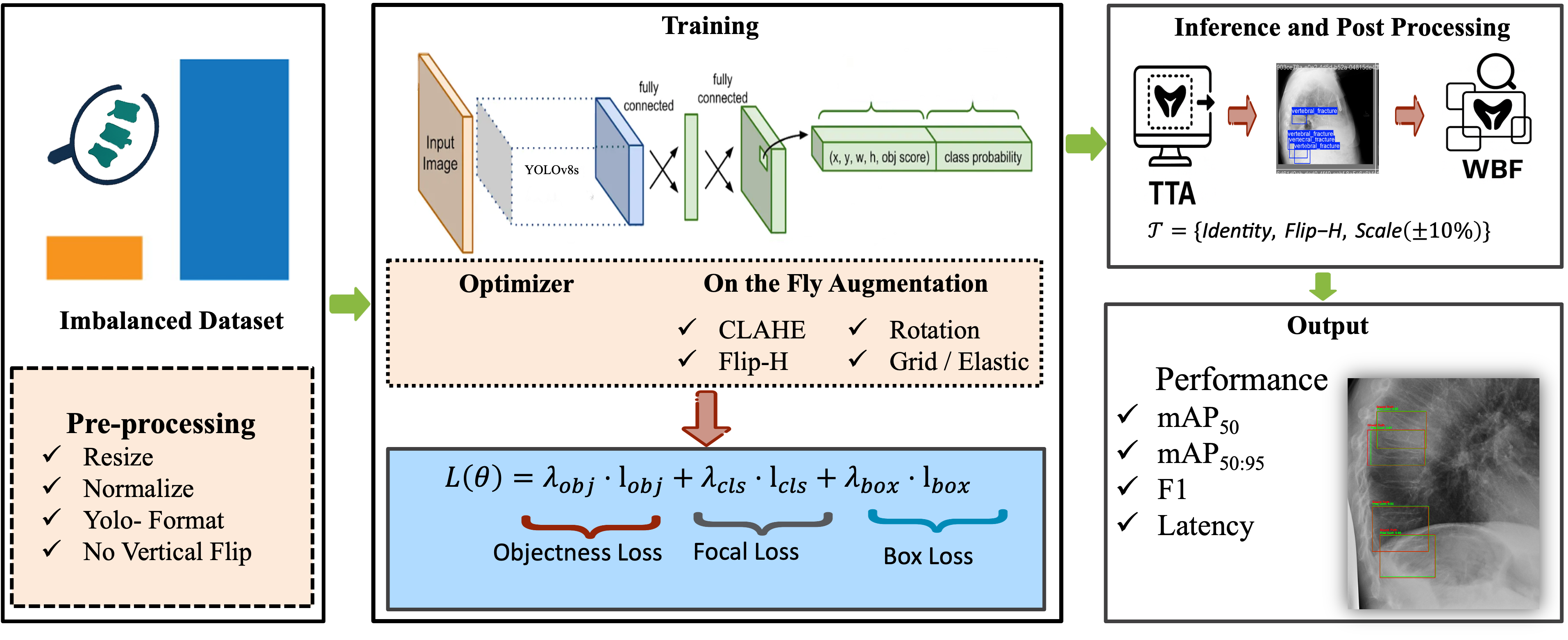 Fracture Finder YOLOv8 pipeline figure